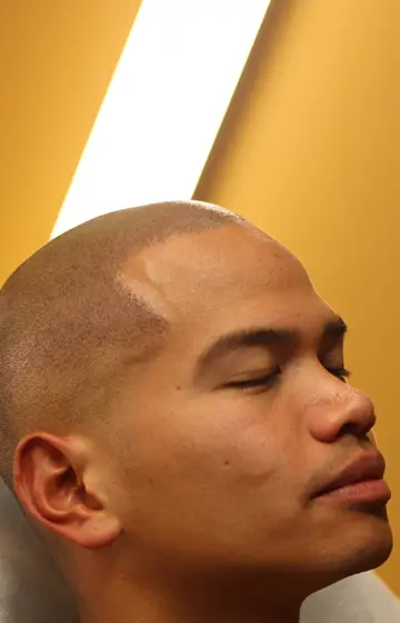 Résultat de micropigmentation capillaire à Montréal avec effet cheveux courts réaliste