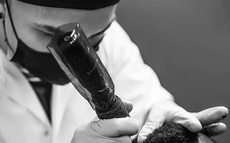 Gros plan en noir et blanc d'un dermographe professionnel utilisé pour une procédure de micropigmentation capillaire à Montréal-Est.